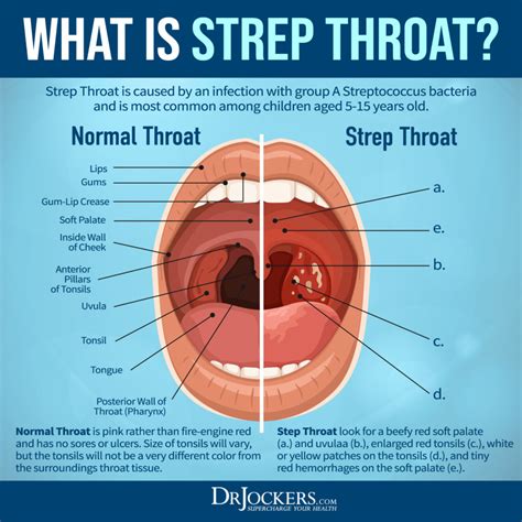 throaypie|Throatpies .